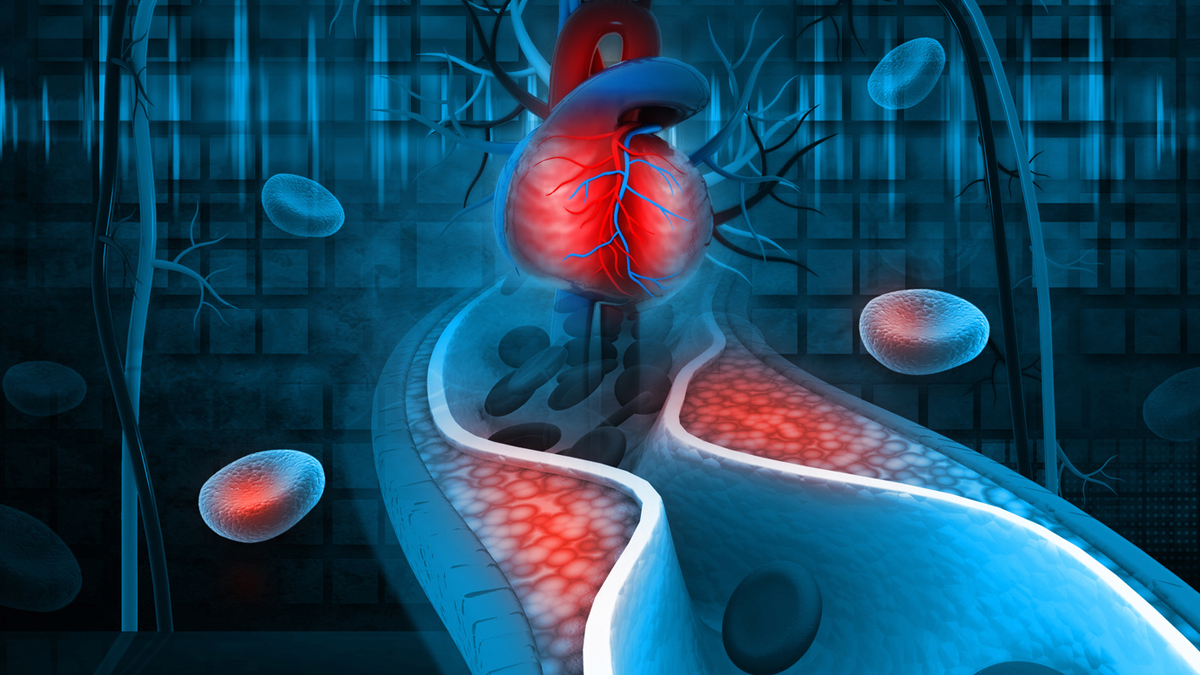 CME-Bild zum Fachgebiet Innere Medizin